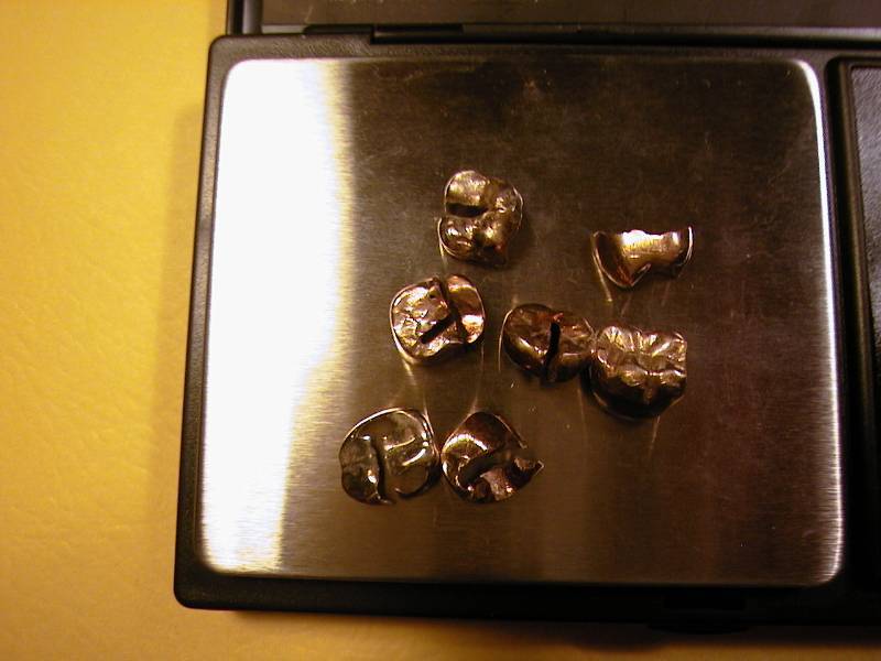 99. 14.79 grams 18K Gold Yellow Dental Gold Scrap Clean