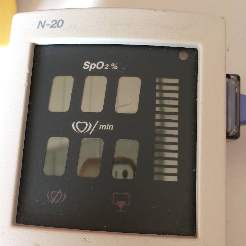 lot 48 image: Retails USED $500 Nellcor N20 Handheld Portable Pulse Oximeter Adult Finger Probe Oxygen Saturation Monitor Medical Device With Case - Excellent Condition