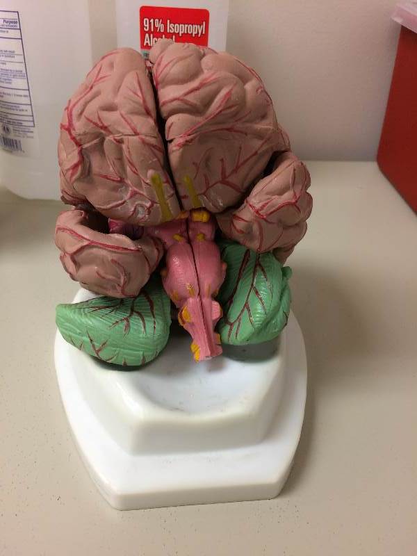 lot 17 image: Retails New $50 Medical Office BRAIN WITH ARTERIES ANATOMY MODEL wStand - Excellent Condition