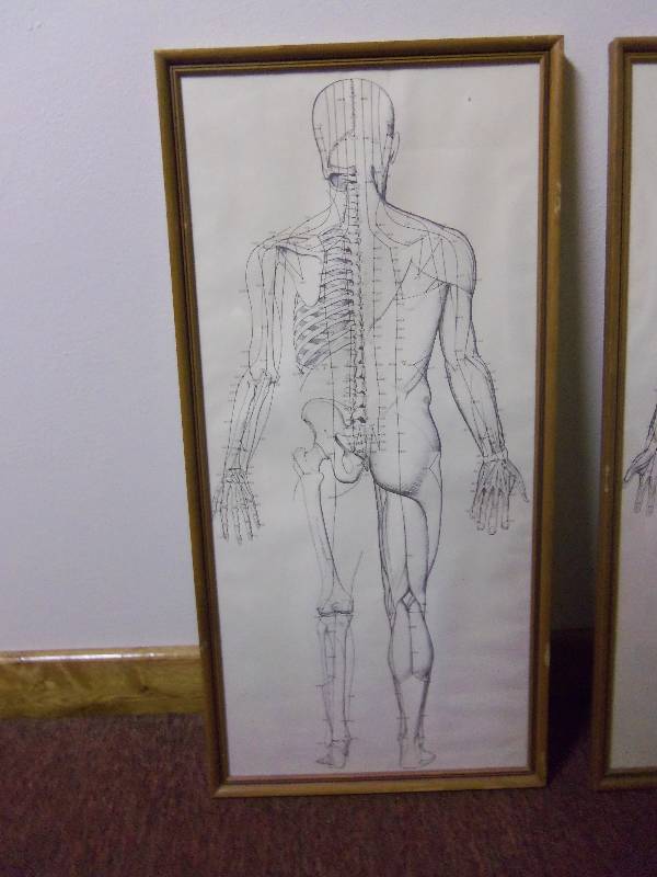 lot 11 image: Lot of 3 - Vintage Framed Medical Prints