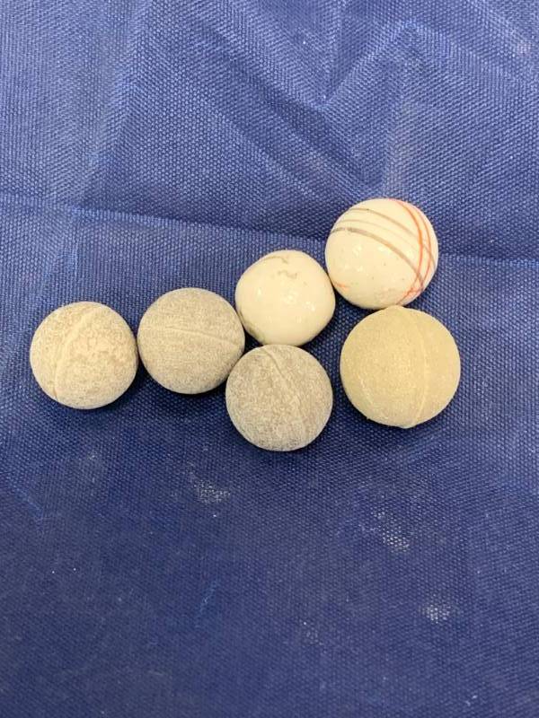 lot 40 image: Lot of 6 Very Old Marbles