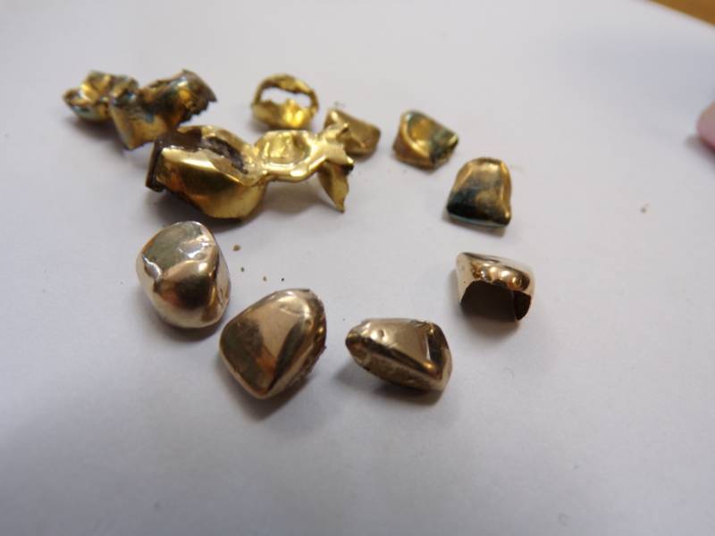lot 147 image: Dental Gold