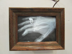 lot 107 image: Vintage Metal Illuminator Light Box w Hand X-Ray