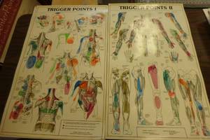 lot 395 image: Trigger point set