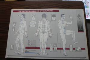lot 406 image: Acupuncture chart