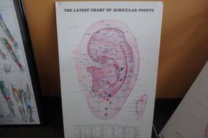 lot 409 image: Auricular Points