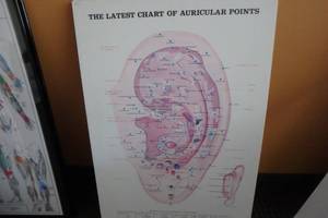 lot 410 image: Auricular Points