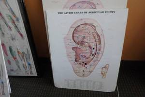 lot 411 image: Auricular Points