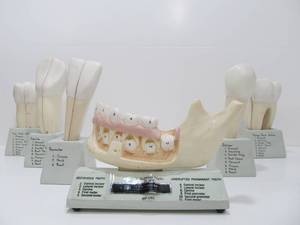 Set of Large Oversize Dental Tooth Educational Displays