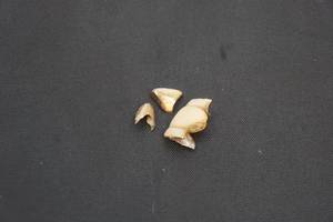 lot 165 image: gold teeth