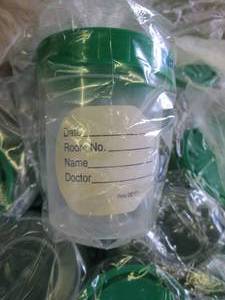 case of urine sample cups and cover...