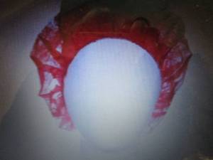lot 435 image: Case of Bouffant Caps Red, Box, L,...