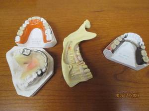 lot 13 image: Model teeth from the 20s and 30s...