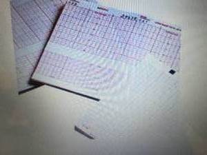 Covidien 30748696 Kendall Medical R...