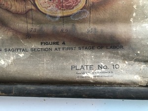 lot 316 image: Large Original Antique Medical Anatomical Chart (AS IS)