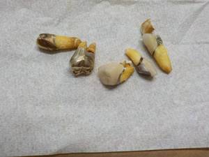 lot 171 image: Gold Teeth...