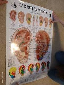 lot 287 image: Large Posters - Ear Reflexology And Stretching Exercises