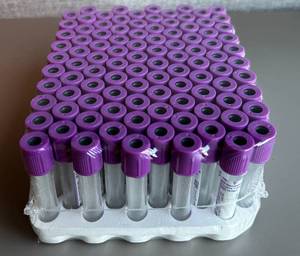 lot 142 image: BD Vacutainer Blood Collection Tubes Expired