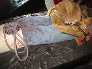 Corpse on a table...
