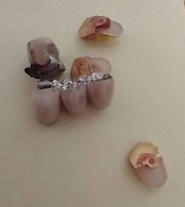 lot 426 image: Mixed Gold Tooth Lot