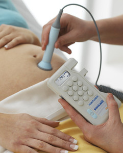 lot 3 image: MSRP $1000 Huntleigh D930 Dopplex Fetal Doppler With Probe &nbsphigh performance transducer enables reliable detection from early gestation right through to delivery, even on obese patients. Great Working Condition